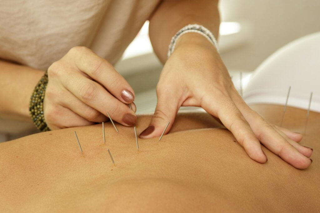 Master is injecting steel needles during procedure of acupuncture therapy