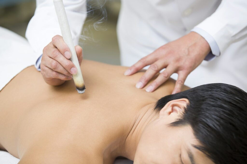 Patient receiving moxibustion