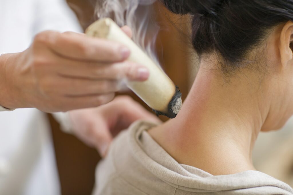 Senior Chinese doctor giving moxibustion